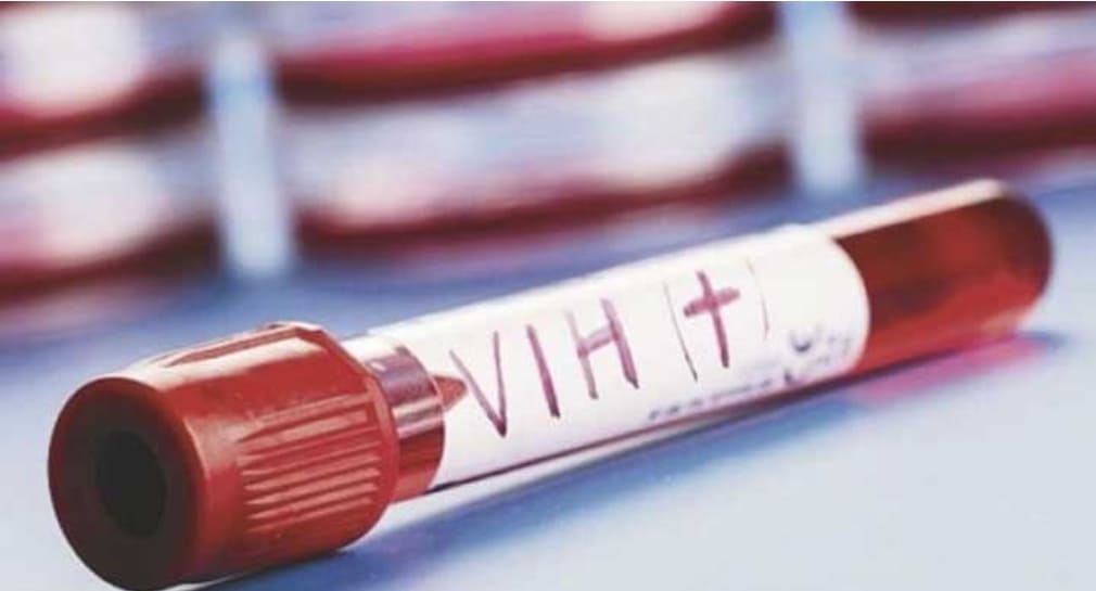 Cofepris expide autorización a autoprueba para diagnóstico de VIH