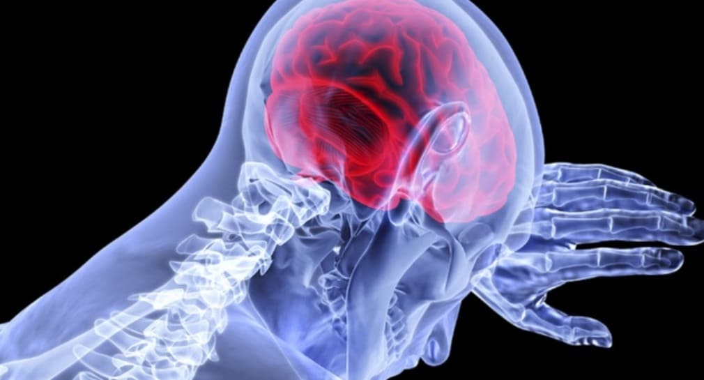 Médicos de EEUU encuentran larvas en cerebro de hombre que sufría migrañas