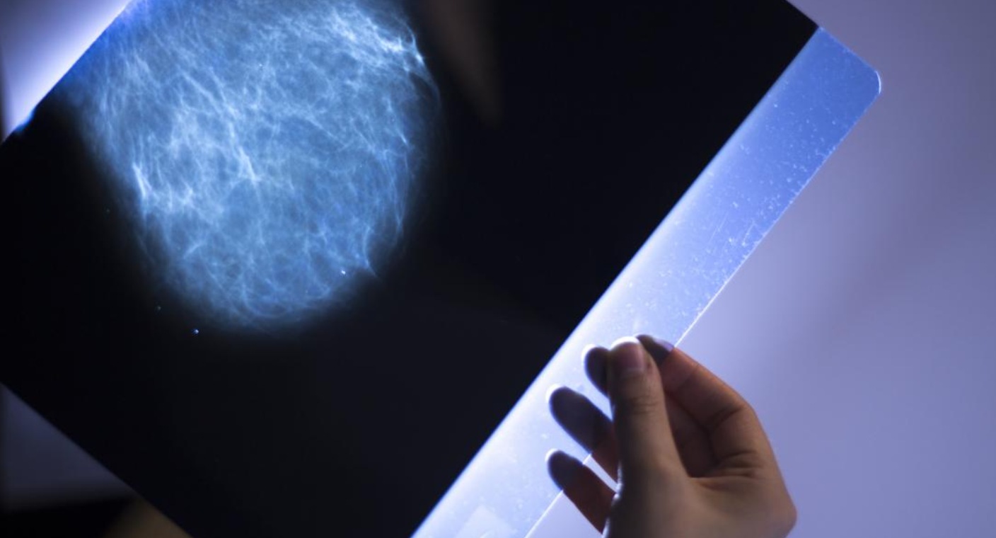 Novedosa terapia muestra eficacia contra cáncer infantil, muestra estudio italiano