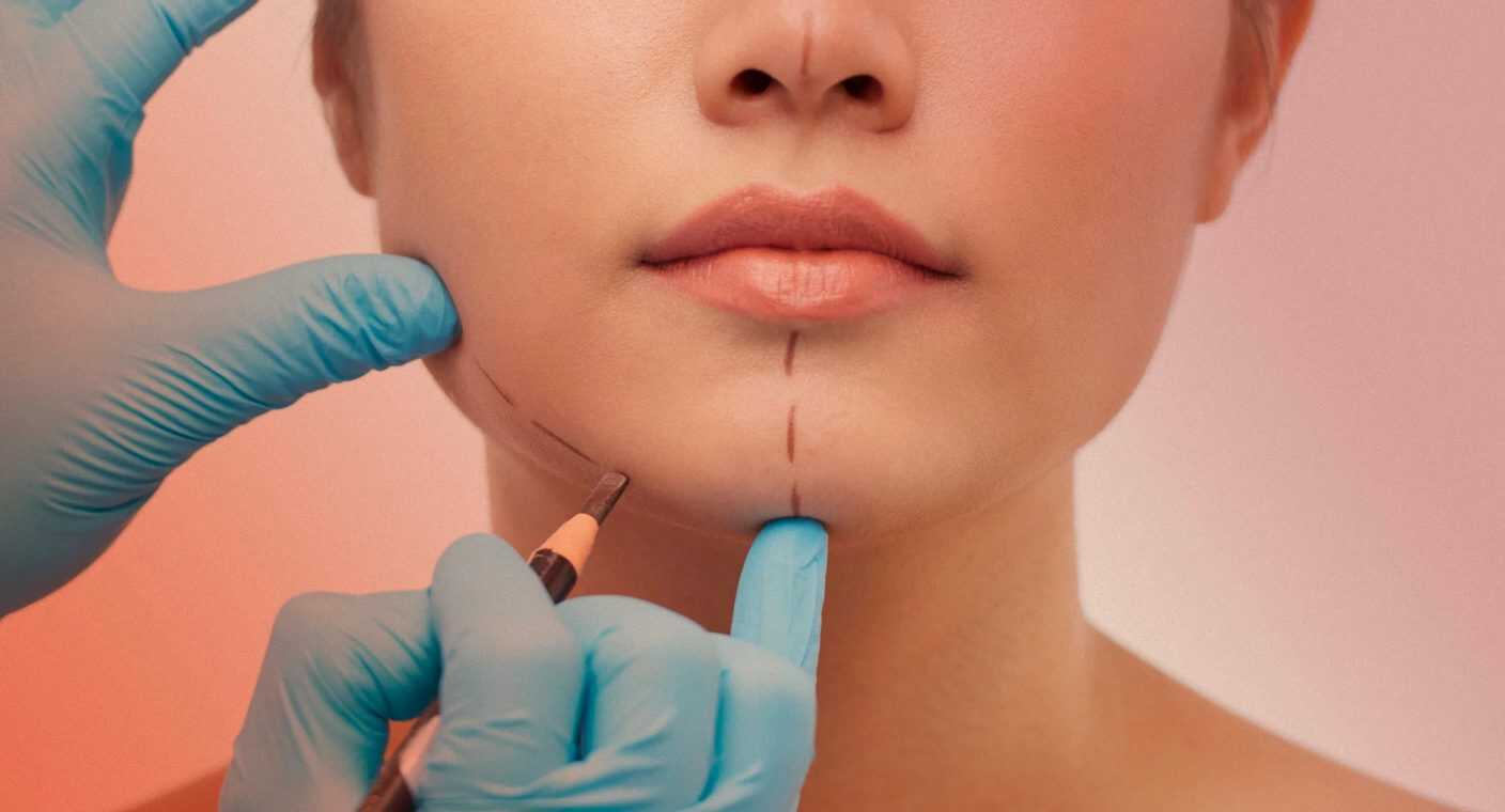 Investiga Barra Sonorense de Abogados 6 casos de malas prácticas de medicina estética en Hermosillo