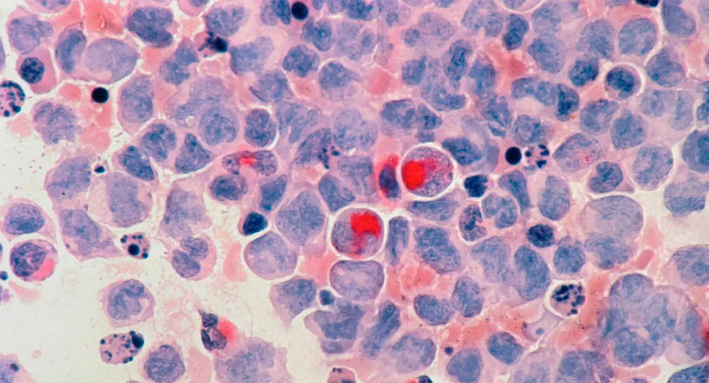 Crean nueva molécula para el tratamiento contra el cáncer