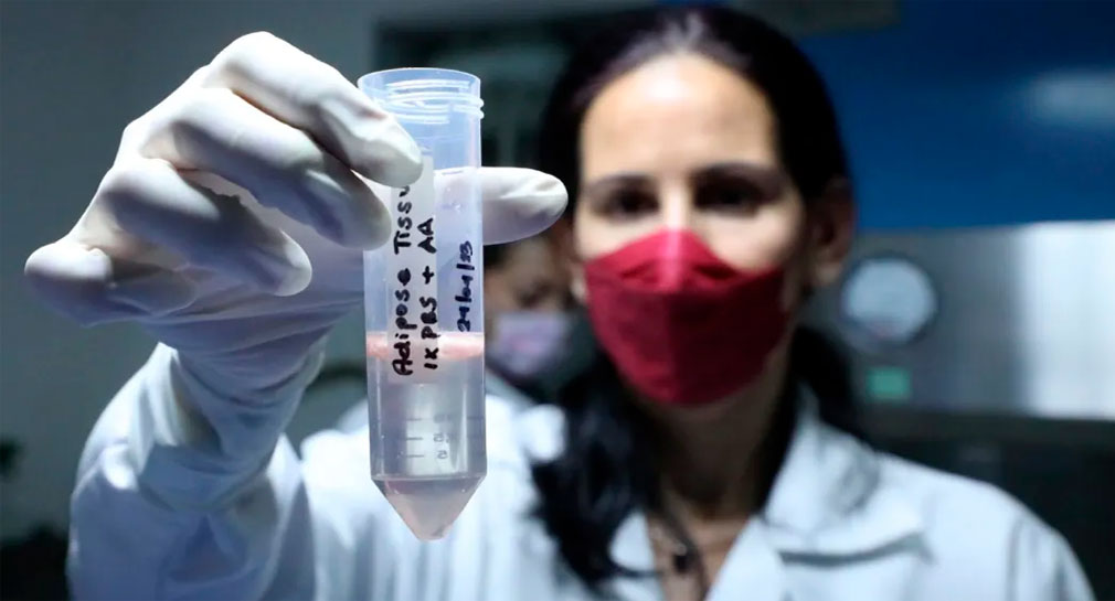 Especialistas del IMSS experimentan con células madre para combatir diabetes tipo 2