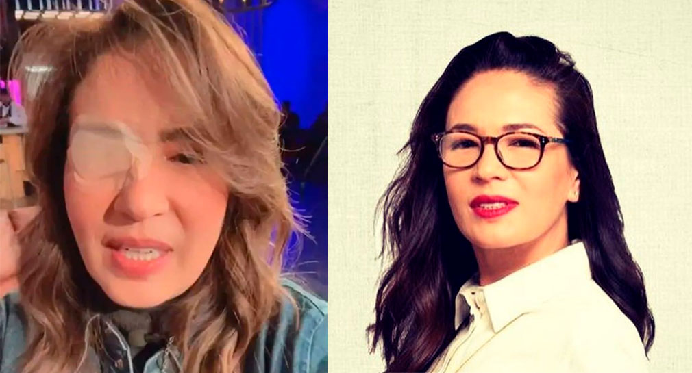 Este es el motivo por el que Yolanda Andrade tiene un parche en el ojo (VIDEO)