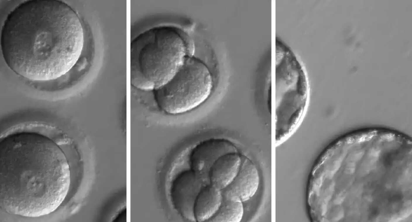 Desarrollan embriones sintéticos humanos sin usar ni óvulos ni espermatozoides