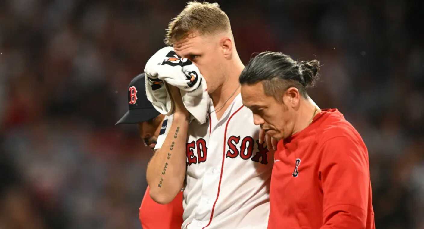 Pitcher de Medias Rojas de Boston sufre fractura facial tras recibir pelotazo en la cara