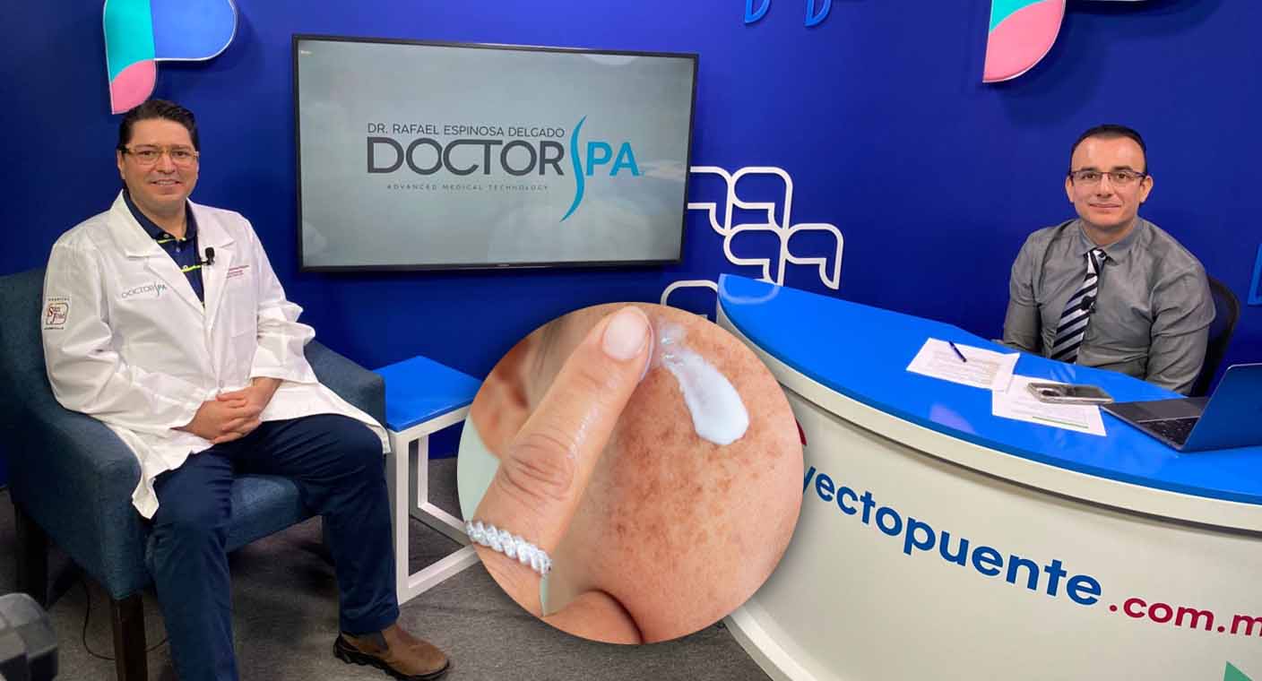 ¿Qué es la melasma o paño?: Dr. Rafael Espinosa Delgado explica cómo prevenirlo y su tratamiento