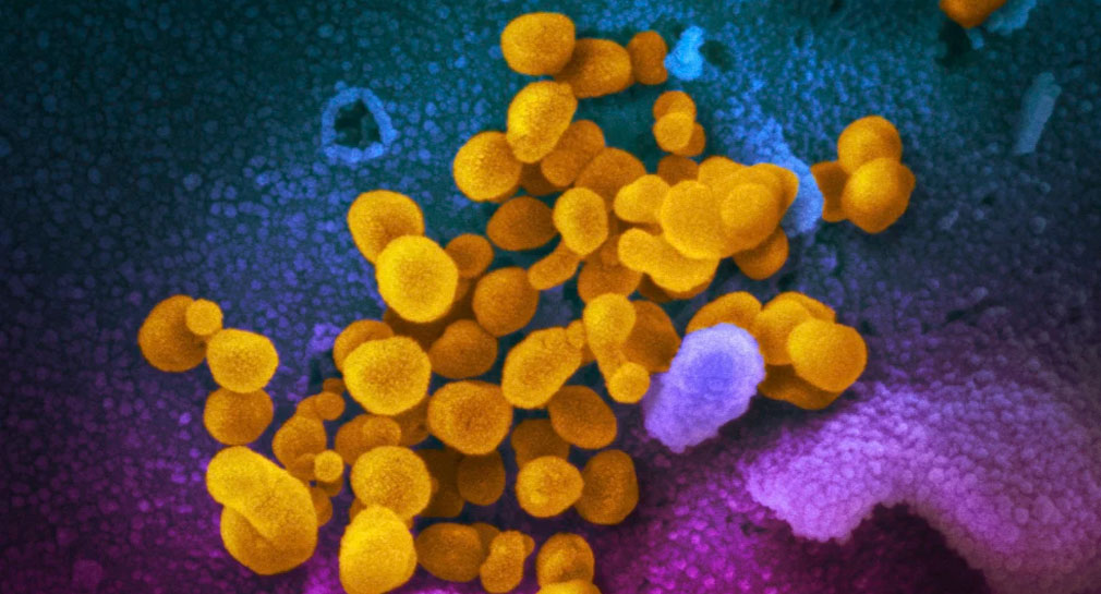 Iniciará EEUU estudios acerca de tratamientos para secuelas de covid