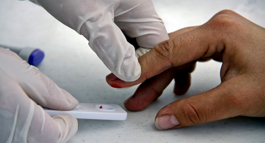 SIDA podría erradicarse para 2030, pero urge financiación, asegura la ONU