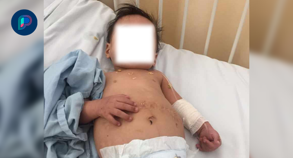 Piden apoyo para Jancel Jovani, internado en el HIES de Hermosillo, para comprar su comida y pañales