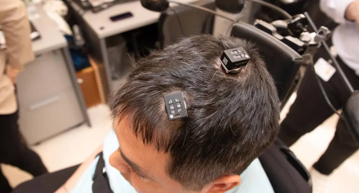 Utilizan Inteligencia Artificial para que un hombre paralítico recupere movimientos