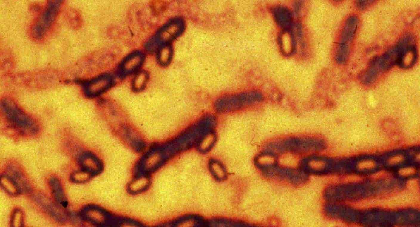 Alerta OMS sobre brote de ántrax que tiene alto riesgo de transmisión