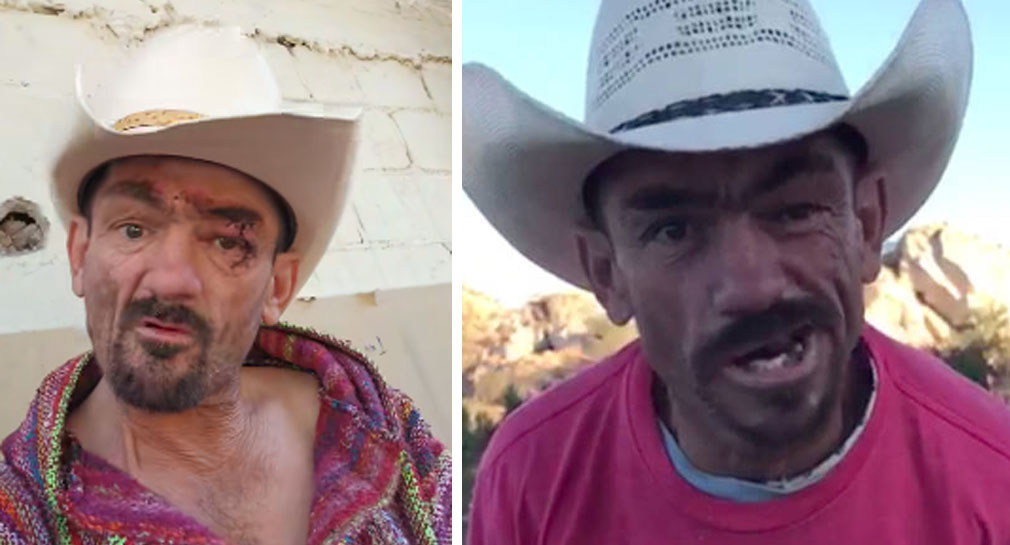 “Estoy vivo de perdida”: ‘Franciskini’ ya está en casa en Hermosillo tras ser hospitalizado por fuerte ataque de epilepsia