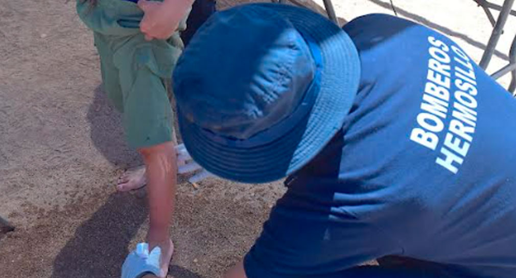 Van más de 30 personas atendidas por picadura de aguamala y mantarraya en Bahía de Kino