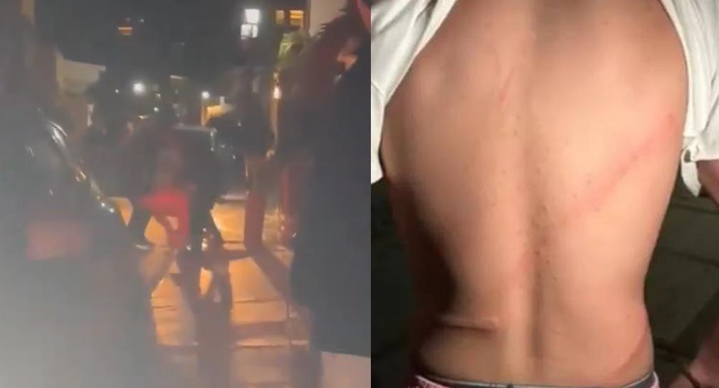 Investigan presunto abuso de autoridad en caso donde policías golpearon un cinto a hombre, en Guaymas