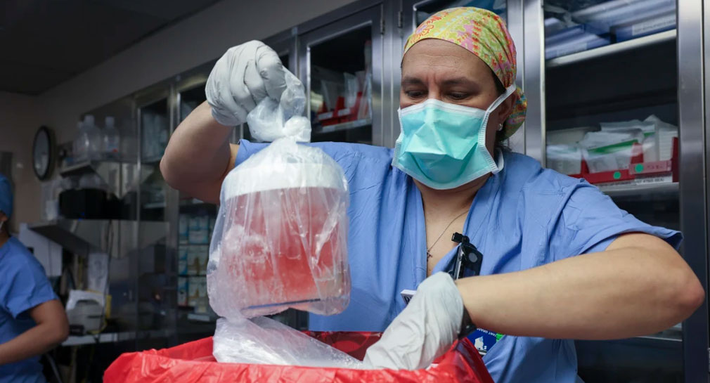 Fallece la primera persona en recibir riñón de cerdo modificado genéticamente