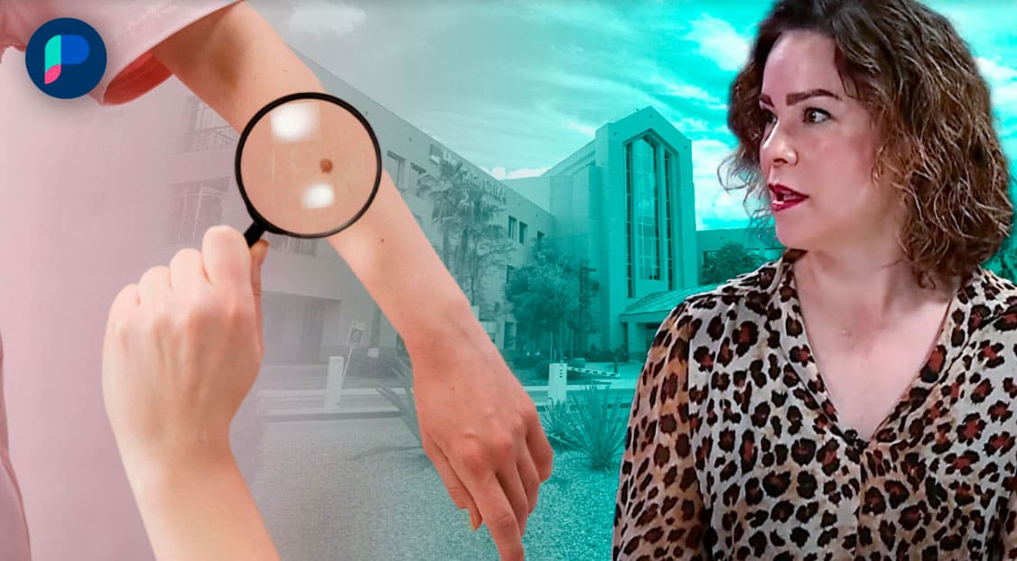 Skin Plástica, de Hospital CIMA en Hermosillo, cuenta con tecnología avanzada para diagnosticar y tratar el cáncer de piel
