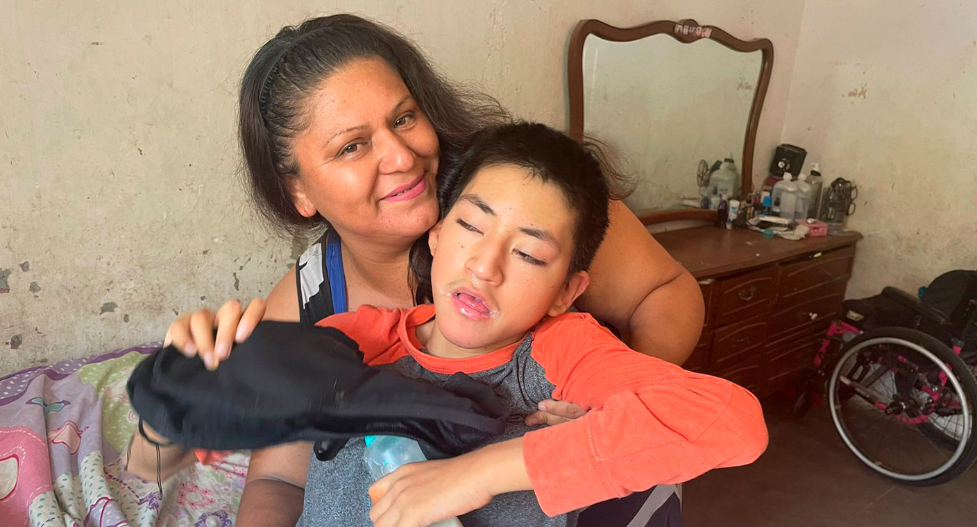 Joven con síndrome de Kabuki y microcefalia solicita apoyo para atenderse en Hermosillo