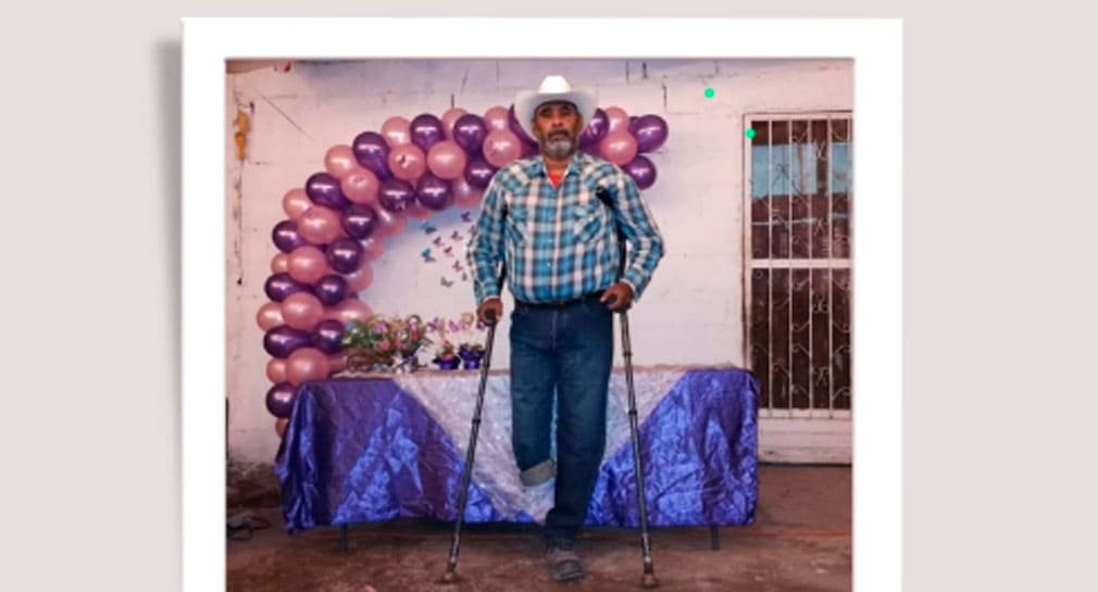 Invitan a participar en rifa de becerra en apoyo a Anselmo Rivera, que busca comprar prótesis de pierna, en Hermosillo