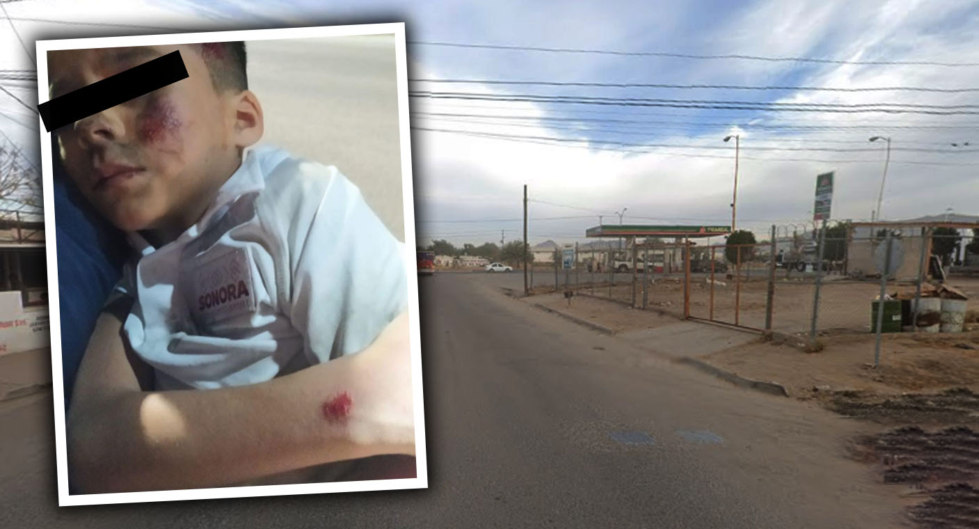 Atropellan a niño de 6 años y conductor se da a la fuga al norte de Hermosillo; Fiscalía inicia investigación para identificar a responsable