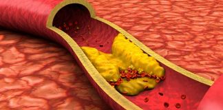 ¿Cuál es el nivel de colesterol que se considera peligroso para la salud? Te contamos