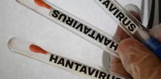 Hantavirus o Coronavirus: Aprende a diferenciarlos