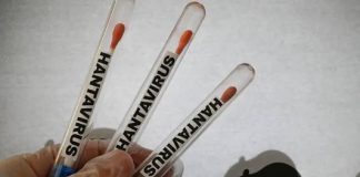 Argentina reporta aumento de hantavirus y duplica casos registrados desde junio de 2025