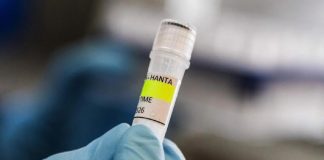 Israel confirma primer caso de hantavirus en un paciente que habría viajado a Europa del Este