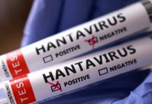 OMS declara “contactos de alto riesgo” a pasajeros de crucero con brote de hantavirus
