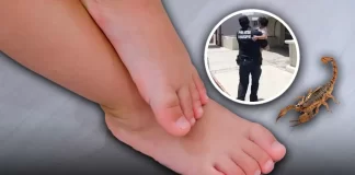 Niña de 3 años sufre picadura de alacrán al oriente de Hermosillo, policías la trasladan al HIES