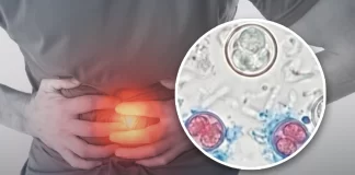 Confirma Salud 33 casos de ‘diarrea explosiva’ en México; investigan posible relación con brote internacional