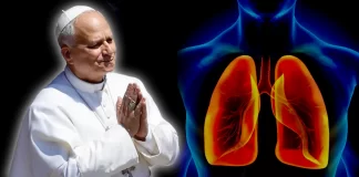 Papa León XIV sale con éxito de operación para extirparle un nódulo pulmonar: Vaticano